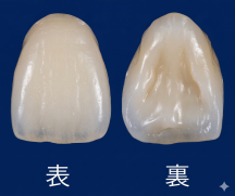 プレミアムジルコニアセラミック