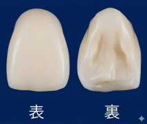 フルジルコニア